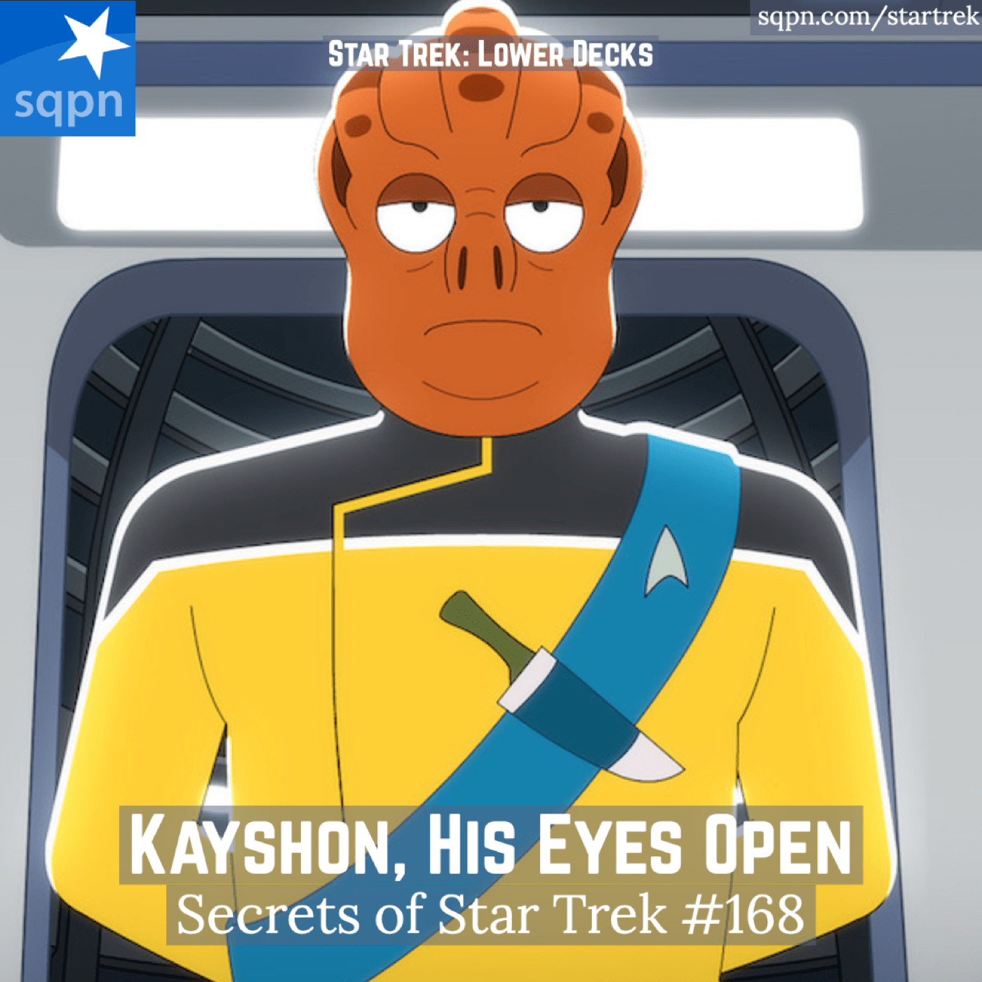 Kayshon, His Eyes Open (LD)
